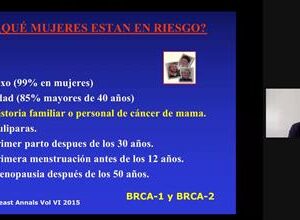 Promueve Toluca acciones para prevenir el cáncer de mama